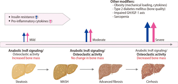 Effects of Metabolic Dysfunction-Associated Steatotic Liver Disease on Bone Density and Fragility Fractures: Associations and Mechanisms.