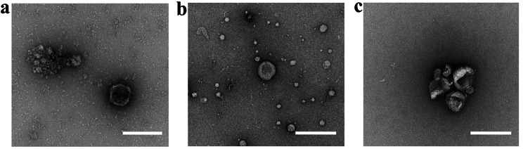 Comparing the Proteomic Profiles of Extracellular Vesicles Isolated using Different Methods from Long-term Stored Plasma Samples.