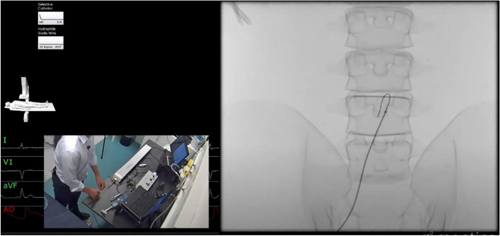 Remote feedback in endovascular simulation training: a mixed-methods study.