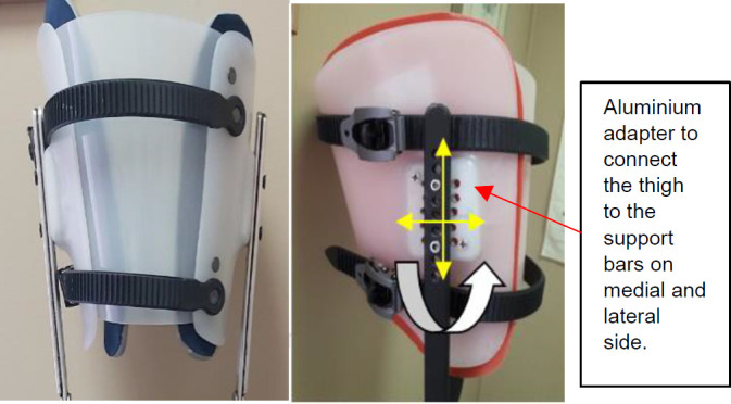 A New Temporary Training Prosthesis for People With Transtibial Amputation: a Technical Note.