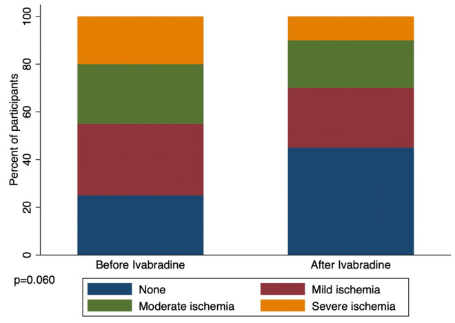 Effects of Ivabradine on Myocardial Perfusion in Chronic Angina: A Prospective, Preliminary, Open-Label, Single-Arm Study.