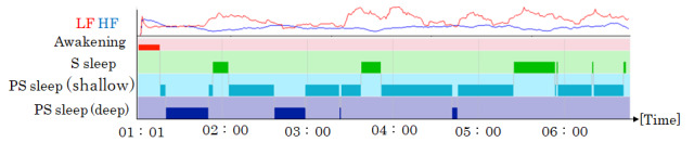 Evaluation of Autonomic Nervous System Function During Sleep by Mindful Breathing Using a Tablet Device: Randomized Controlled Trial.