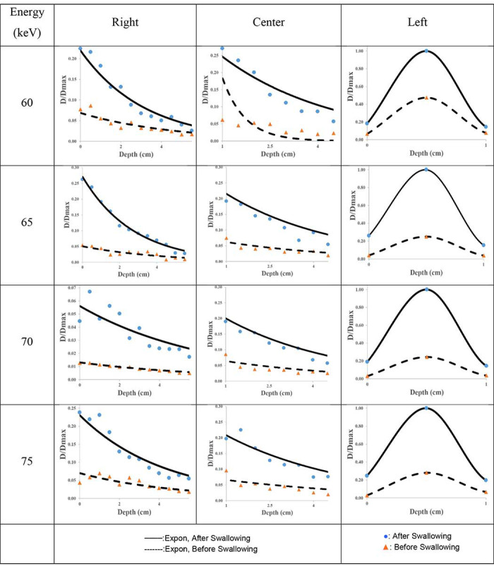 Assessment of the Absorbed Dose Variations in the Thyroid Gland Exposed to Orthopantomography (OPG) while Swallowing: A Novel Approach to Radiation Protection.