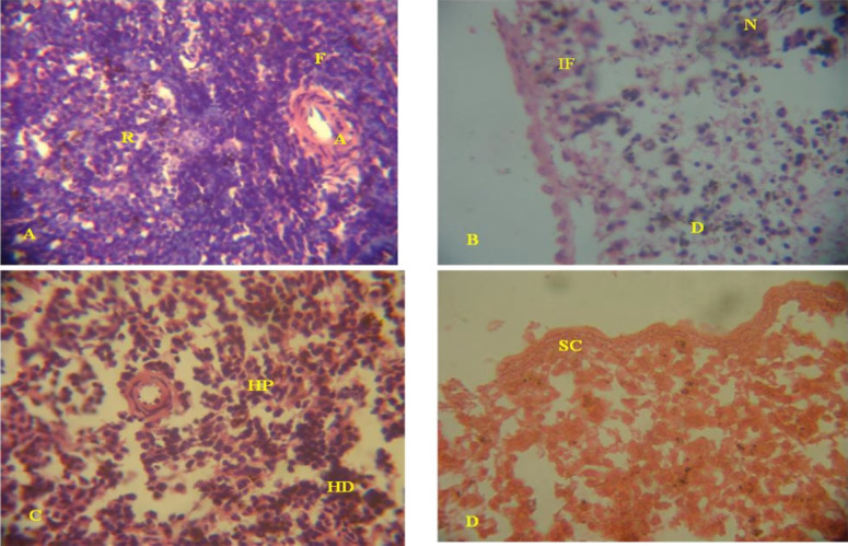 Alterations in viscera histoarchitecture and organosomatic index as biomarkers of toxicity induced by Aba-Eku and Olusosun solid waste landfill leachates in Rattus norvegicus.