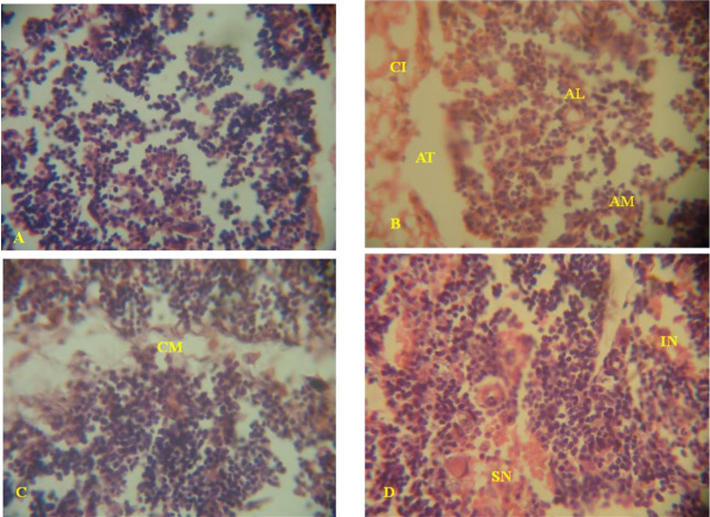 Alterations in viscera histoarchitecture and organosomatic index as biomarkers of toxicity induced by Aba-Eku and Olusosun solid waste landfill leachates in Rattus norvegicus.