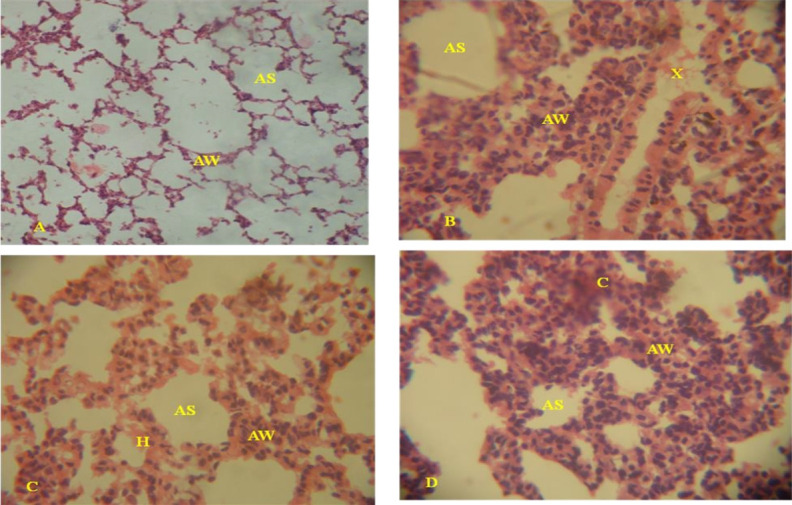 Alterations in viscera histoarchitecture and organosomatic index as biomarkers of toxicity induced by Aba-Eku and Olusosun solid waste landfill leachates in Rattus norvegicus.