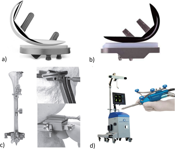 Reducing edge loading and alignment outliers with image-free robotic-assisted unicompartmental knee arthroplasty: a case controlled study.