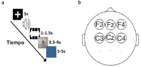 [Paresis of an upper extremity. Action observation and motor imagery in recovery of patients with chronic stroke].