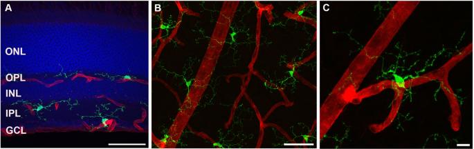 The role of microglia in the development of diabetic retinopathy