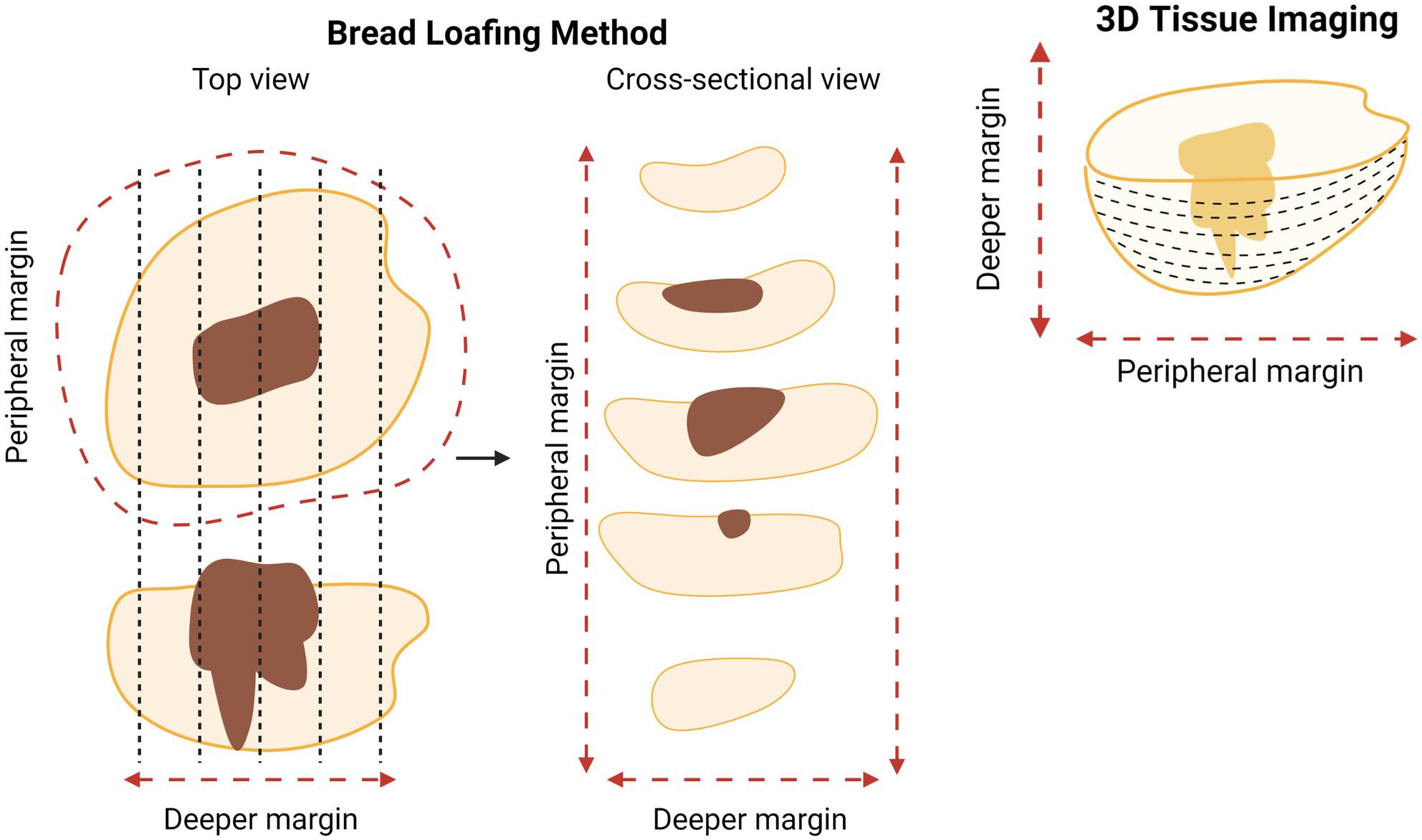 Visualising cancer in 3D: 3-Dimensional Tissue Imaging for management of cutaneous basal cell carcinoma