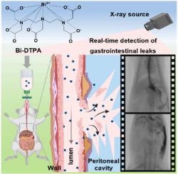 Real-time detection of gastrointestinal leaks via bismuth chelate-enhanced X-ray gastroenterography