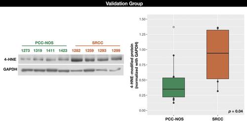 Clinicopathological features and cancer transcriptomic profiling of poorly cohesive gastric carcinoma subtypes