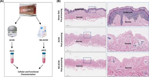 Biological attributes required for epidermal regeneration: Evaluation of the next-generation autologous cell harvesting device