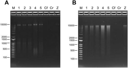 Nanopore-Enabled Microbiome Analysis: Investigating Environmental and Host-Associated Samples in Rainbow Trout Aquaculture