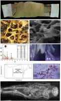 Analytical methods for studying mummification technique and degradation process of a human mummy from the late period