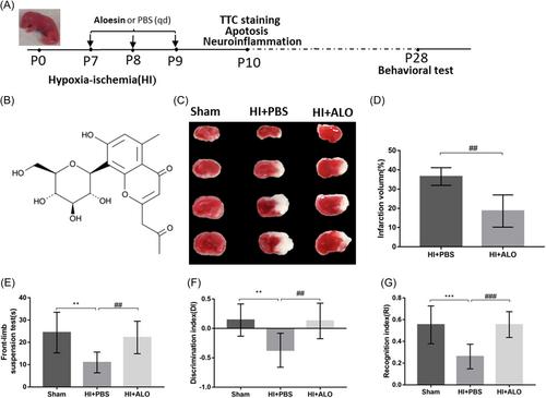 Aloesin ameliorates hypoxic-ischemic brain damage in neonatal mice by suppressing TLR4-mediated neuroinflammation