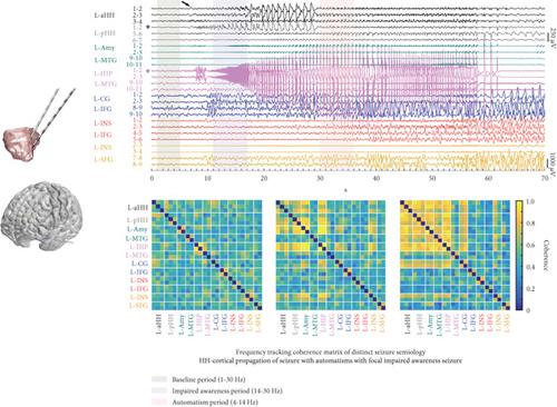 Epileptic Network Surgery: From Network Basis to Clinical Practice