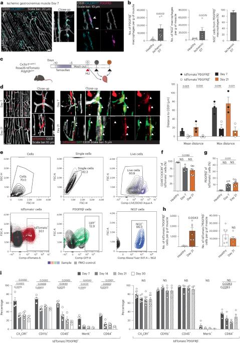 Macrophages upregulate mural cell-like markers and support healing of ischemic injury by adopting functions important for vascular support