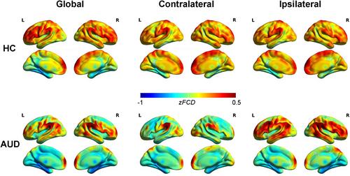 Global, interhemispheric and intrahemispheric functional connection patterns in male adults with alcohol use disorder