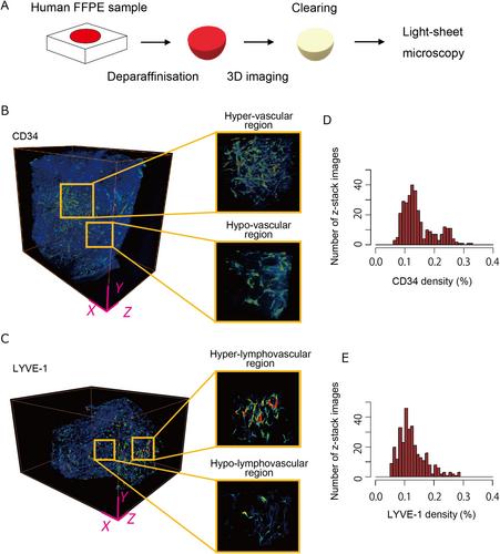 Volumetric imaging of the tumor microvasculature reflects outcomes and genomic states of clear cell renal cell carcinoma