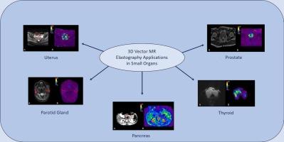 3D vector MR elastography applications in small organs