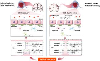 The protective effects of Axitinib on blood-brain barrier dysfunction and ischemia-reperfusion injury in acute ischemic stroke