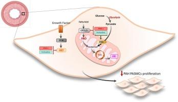 Fluorinated perhexiline derivative attenuates vascular proliferation in pulmonary arterial hypertension smooth muscle cells