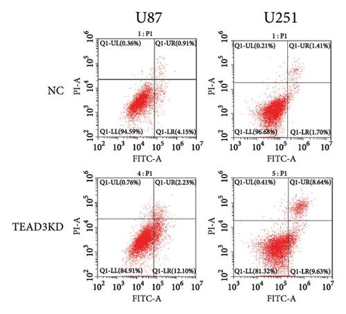 Identification and Validation of TEAD Family’s Prognostic Effects and Immune Microenvironment Regulations in Glioma