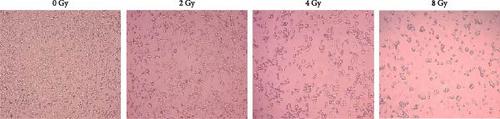 Liposomal-Naringenin Radiosensitizes Triple-Negative Breast Cancer MDA-MB-231 Cells In Vitro