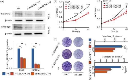 SERPINC1, a new prognostic predictor of colon cancer, promote colon cancer progression through EMT