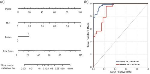 Radiomics models to predict bone marrow metastasis of neuroblastoma using CT