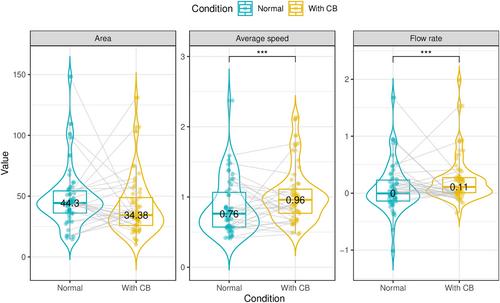 Haemodynamic effect of a leg compression bandage on the distal posterior tibial artery using 4D flow magnetic resonance imaging: A quantitative study