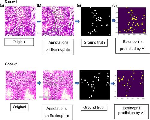 Eosinophil count in cecal biopsies using artificial intelligence-based machine learning