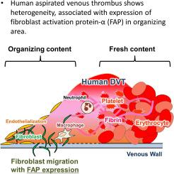 Expression of fibroblast activation protein-α in human deep vein thrombosis