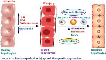 Cellular and molecular mechanisms of hepatic ischemia-reperfusion injury: The role of oxidative stress and therapeutic approaches