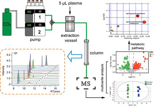 Lipidomics Study of Type 1 Diabetic Rats Using Online Phase Transition Trapping-Supercritical Fluid Extraction-Chromatography Coupled with Quadrupole Time-of-Flight Tandem Mass Spectrometry