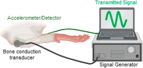 Developing and Investigating a Nanovibration Intervention for the Prevention/Reversal of Bone Loss Following Spinal Cord Injury