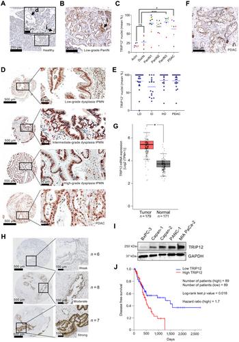 The E3 ubiquitin ligase TRIP12 is required for pancreatic acinar cell plasticity and pancreatic carcinogenesis