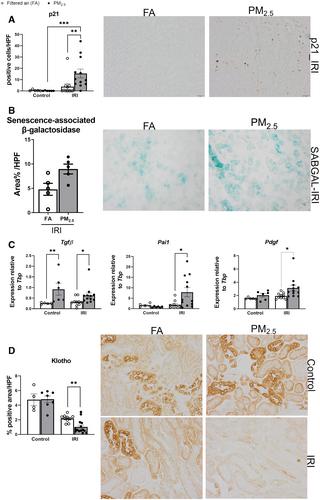 Air pollution aggravates renal ischaemia–reperfusion-induced acute kidney injury