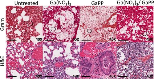 Dual Gallium Drug Treatment Against Carbapenem-Resistant Klebsiella Pneumoniae: Efficacy and Potential Mechanism(s) of Action and Resistance