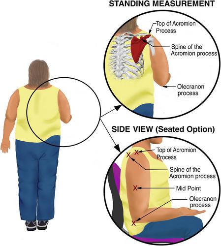 Inter-observer reliability and anatomical landmarks for arm circumference to determine cuff size for blood pressure measurement