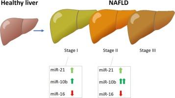 Evaluation of the diagnostic role of circulating miR-16, miR-10b, and miR-21 expression in patients with nonalcoholic fatty liver disease