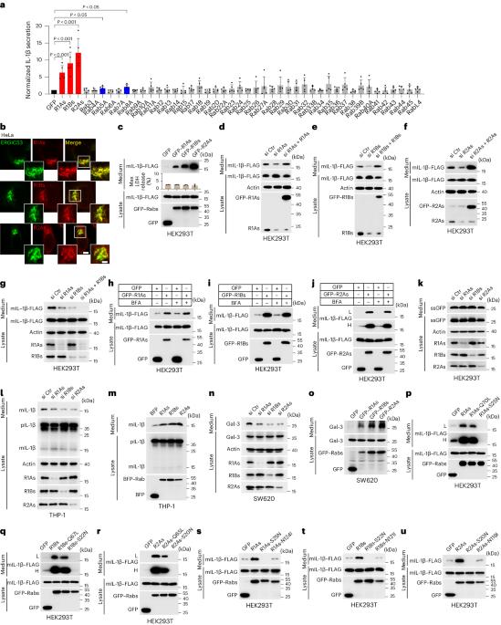 A dual role of ERGIC-localized Rabs in TMED10-mediated unconventional protein secretion