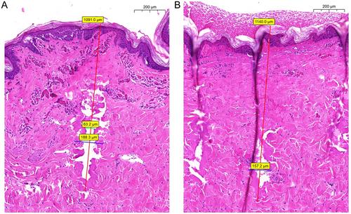 Evaluation of a Novel Ablative 1940 nm Pulsed Laser for Skin Rejuvenation