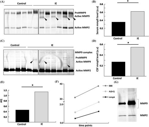 Blood-brain barrier dysfunction and decreased transcription of tight junction proteins in epileptic dogs