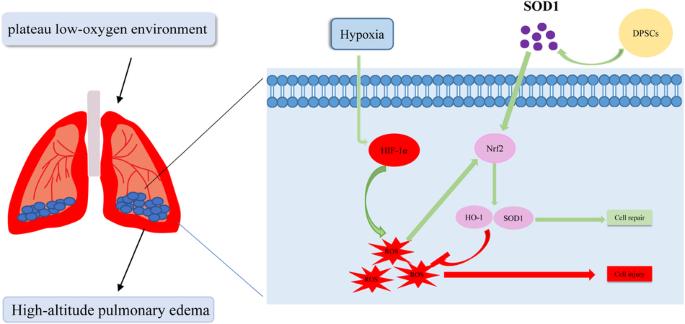 Superoxide dismutase 1-modified dental pulp stem cells alleviate high-altitude pulmonary edema by inhibiting oxidative stress through the Nrf2/HO-1 pathway