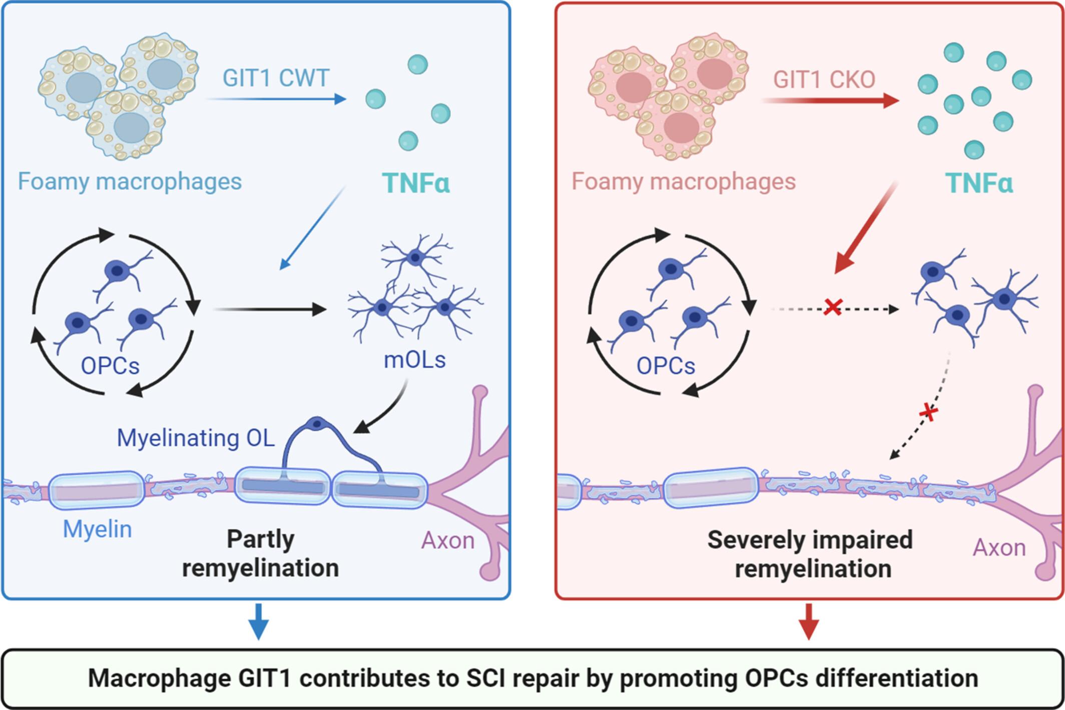 Macrophage GIT1 promotes oligodendrocyte precursor cell differentiation and remyelination after spinal cord injury