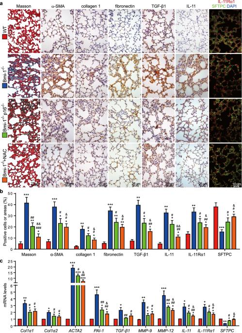 Author Correction: TGF-β1/IL-11/MEK/ERK signaling mediates senescence-associated pulmonary fibrosis in a stress-induced premature senescence model of Bmi-1 deficiency