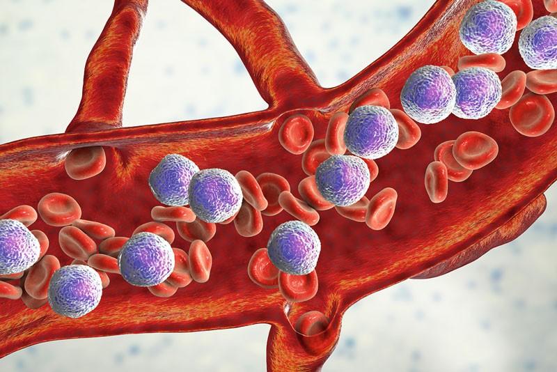 Menin inhibitors seek to debut as newest targeted therapy for leukaemia