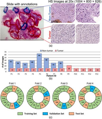 Hybrid brain tumor classification of histopathology hyperspectral images by linear unmixing and an ensemble of deep neural networks